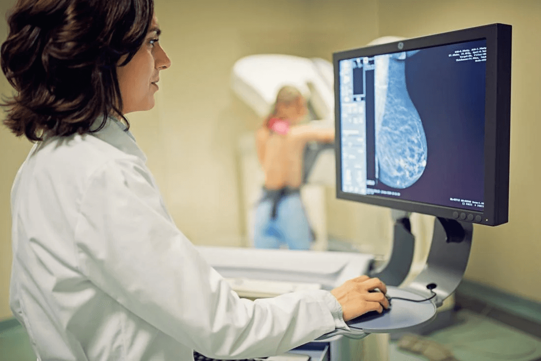 Diplomado de imagenología mamaria (Arg)