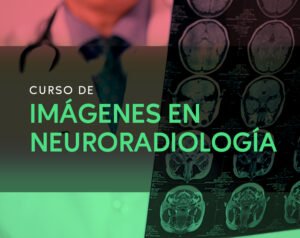 RAD_14_NeuroRadiología